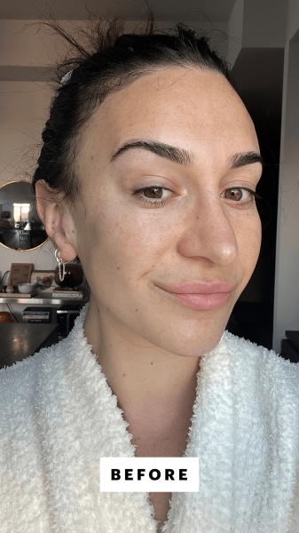 Allure commerce writer Lily Wohlner before applying Trinny Londons Naked Ambition Serum